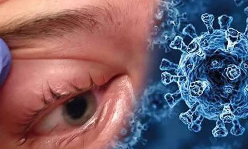 कालो ढुसीबाट कसरी बच्ने  ?