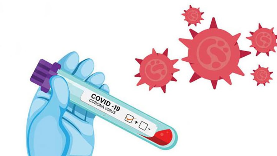 आयल निगमका कर्मचारीको पिसिआर परीक्षण