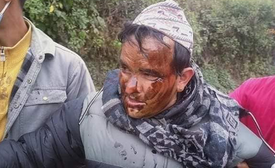 विप्लव कार्यकर्ताद्धारा वडाध्यक्षलाई कालोमोसो