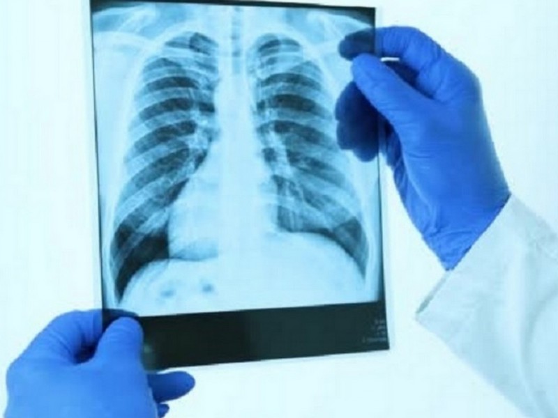 भिडियो एक्स–रे सेवा सुरु