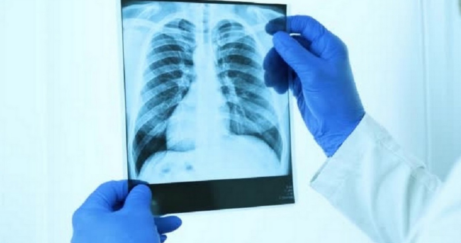 भिडियो एक्स–रे सेवा सुरु